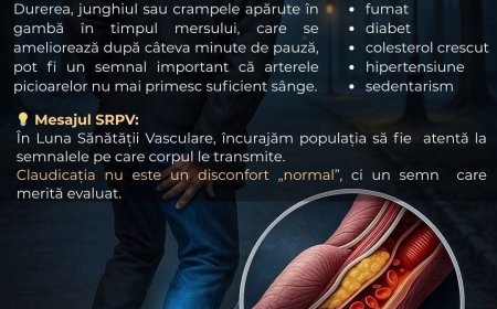 Gambe dureroase la mers? Arterele tale sunt în pericol