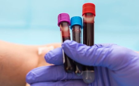 ANALIZE MEDICALE GRATUITE, LA ÎNCEPUT DE AN
