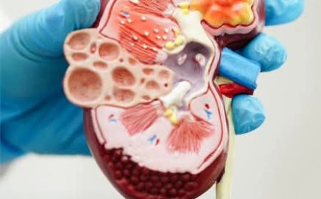 Cancerul renal, afecțiunea oncologică depistată în cazuri avansate