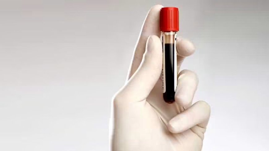 Analiza care ajută la diagnosticarea prediabetului